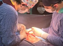 برای اولین بار در گیلان صورت گرفت؛ انجام عمل جراحی اترزی صفراوی بر روی نوزاد ۵۰ روزه