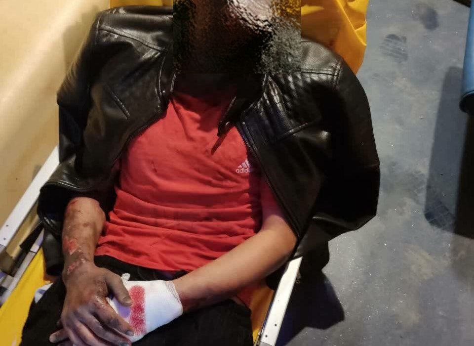 امدادرسانی مرکز اورژانس گیلان به مصدوم انفجار مواد محترقه در شهر حویق