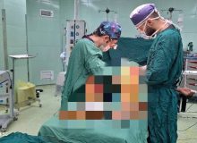 برای اولین بار در شهرستان لاهیجان؛ انجام عمل پیوند (بای پس) عروق پا در بیمارستان دکتر پیروز