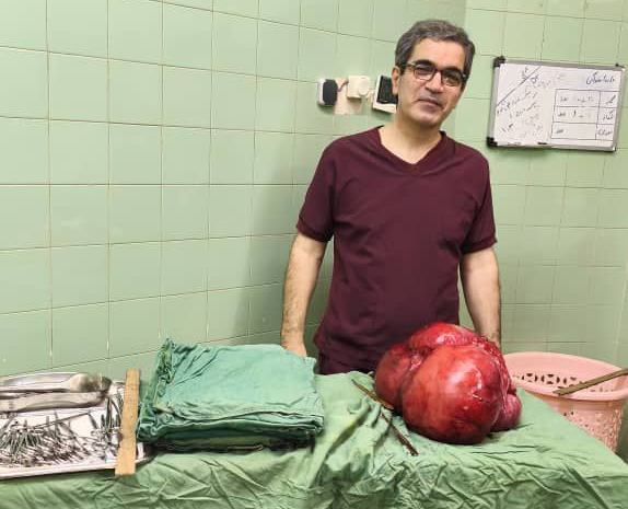 تلاش موفق تیم جراحی بیمارستان شهید انصاری رودسر: خارج کردن توده سنگین از شکم بیمار پس از سالها درد