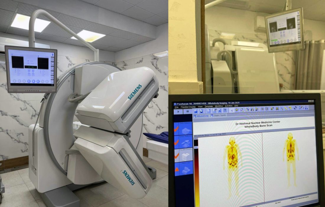 انجام نخستین درمان هدفمند سرطان پروستات پیشرفته با رادیوداروی لوتیشیوم ۱۷۷ در گیلان